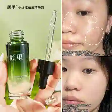 颜里小绿瓶祛痘精华液 祛痘