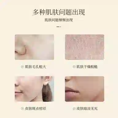 颜里胶态硫痘肌精华液 保湿控油