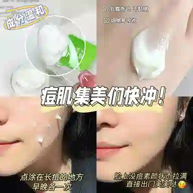 樱素肌  亮肤面霜 祛痘 中性肌痘痘肌油痘肌