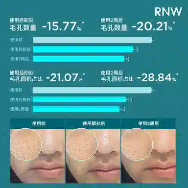 RNW100ml