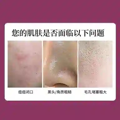 30ml