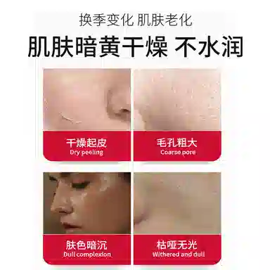 SOD 300g