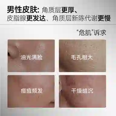 法兰琳卡 男士控油祛痘护肤礼盒套装 保湿去角质清洁清爽舒缓补水 双管洁面水乳氨基酸泡沫洗面奶男生专用 敏感肌可用