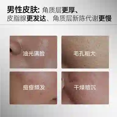 法兰琳卡 男士控油祛痘护肤礼盒套装 保湿去角质清洁清爽舒缓补水 双管洁面水乳氨基酸泡沫洗面奶男生专用 敏感肌可用