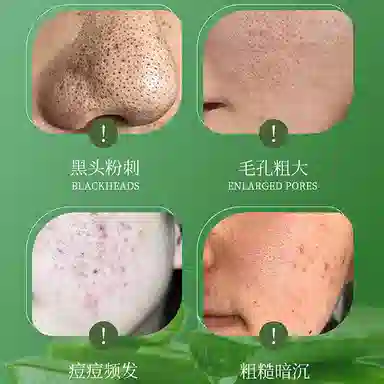 雅屏  去角质 深层清洁