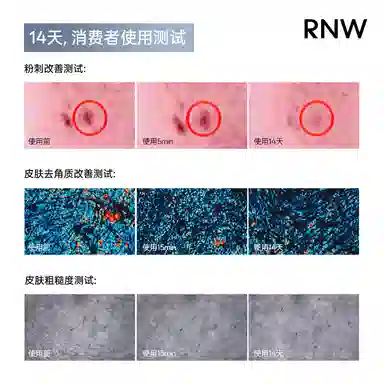 RNW 180ml