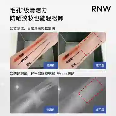 RNW