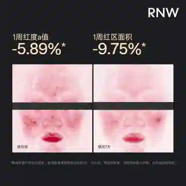 RNW 100g150g