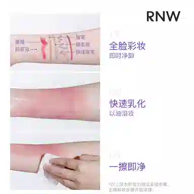 RNW