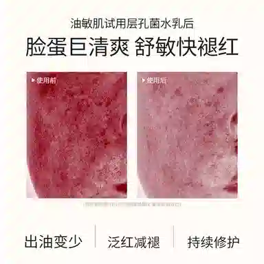 溪木源 层孔菌 水乳洗面奶护肤套装敏感肌混油皮 舒缓修护补水控油清洁