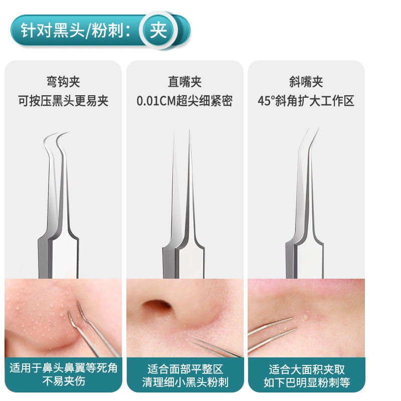 未来枫情 去黑头针暗疮挤痘痘清刮闭口面部粉刺针套装