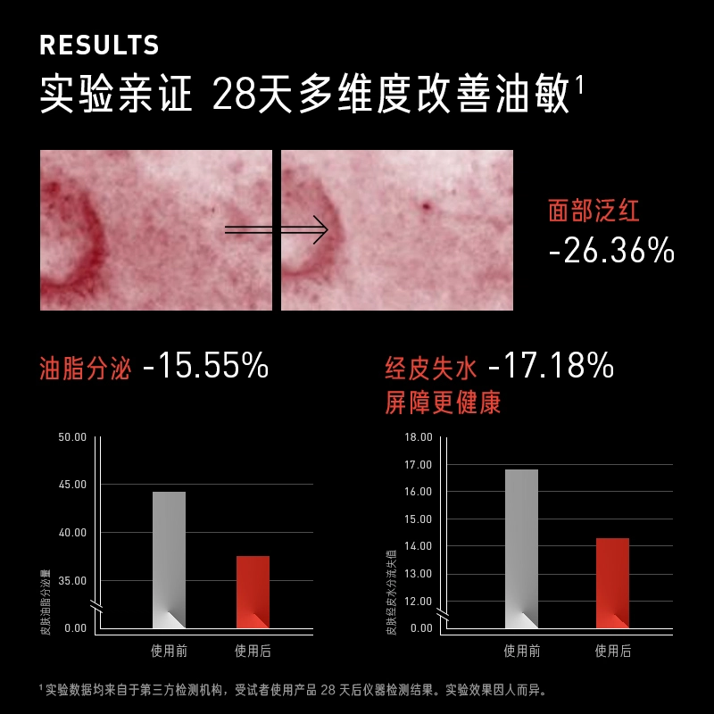 15ml30ml