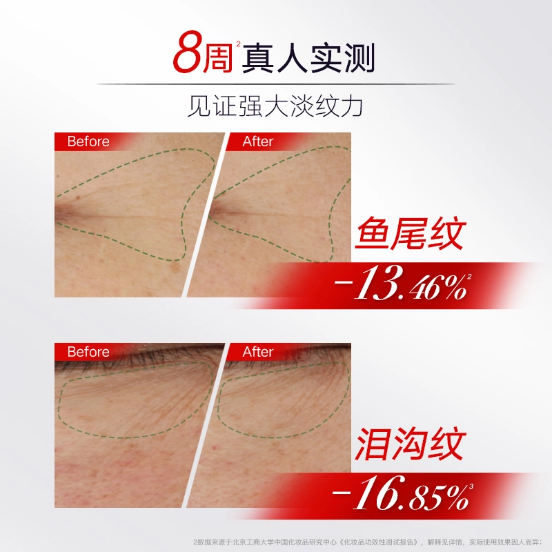 10g*220g20g*2