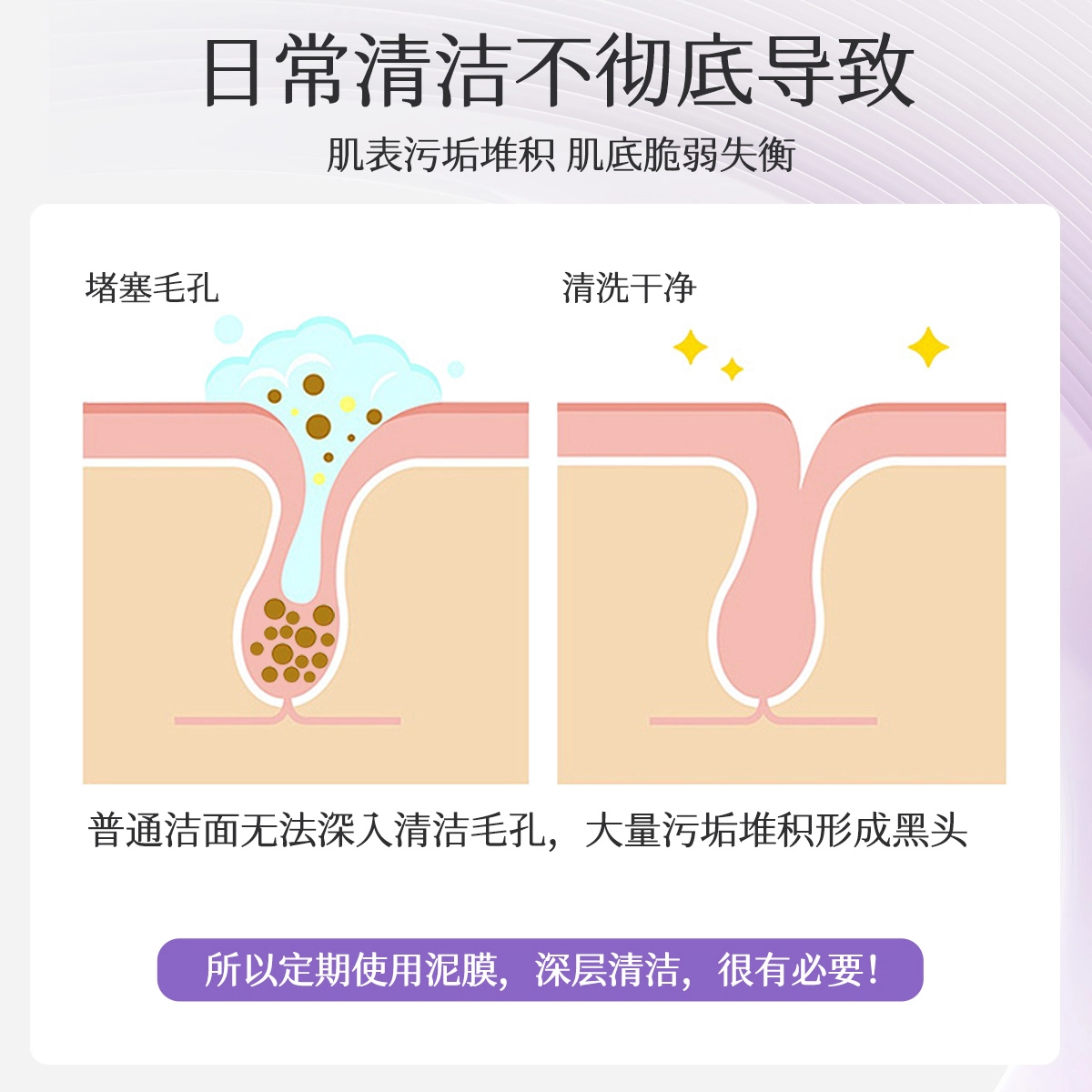 活泉紫苏净颜清洁控油舒缓白泥膜 保湿去角质去黑头收缩毛孔祛痘祛粉刺 去闭口改善肌肤深层洁净久敷不拔干顺滑涂抹面膜
