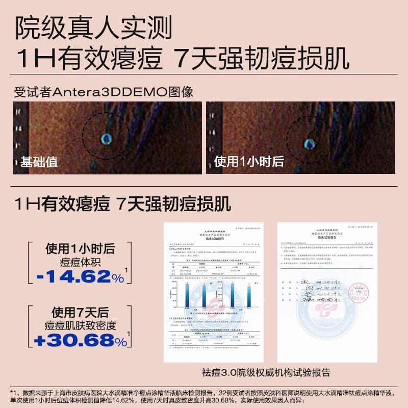 3 3.0 10ml