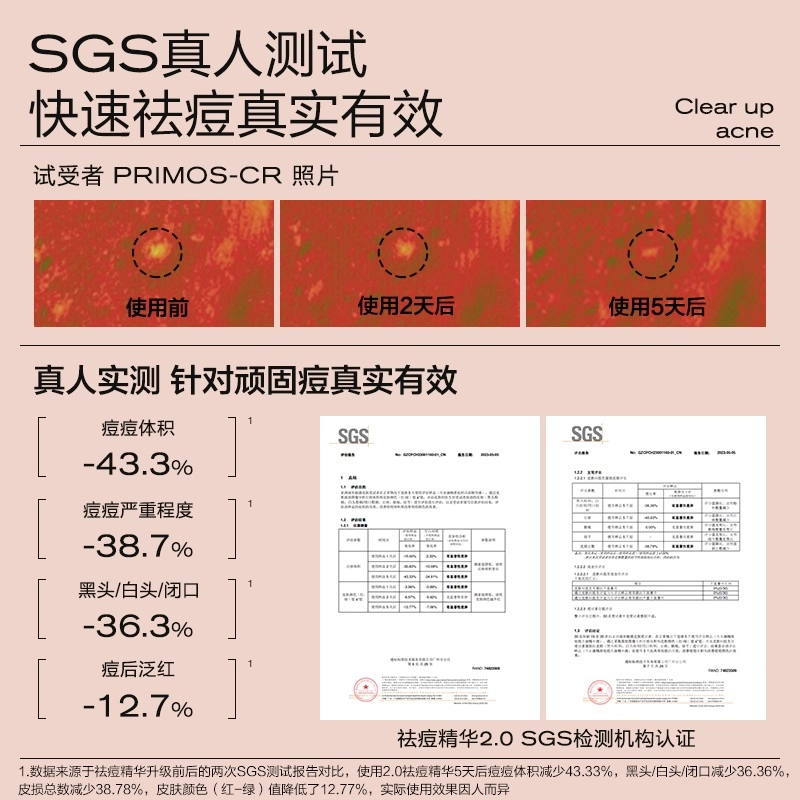 大水滴 精准祛痘点涂精华液 舒缓