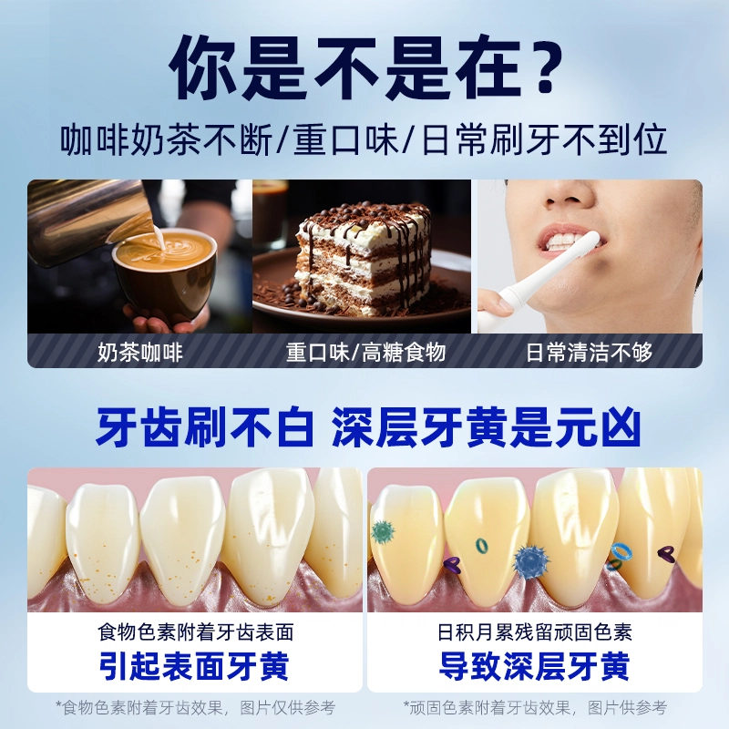 和风雨 小苏打美白牙膏祛黄去牙渍烟渍去口臭 去牙渍清新口气清洁美白 清新口气笑出自信  单只装