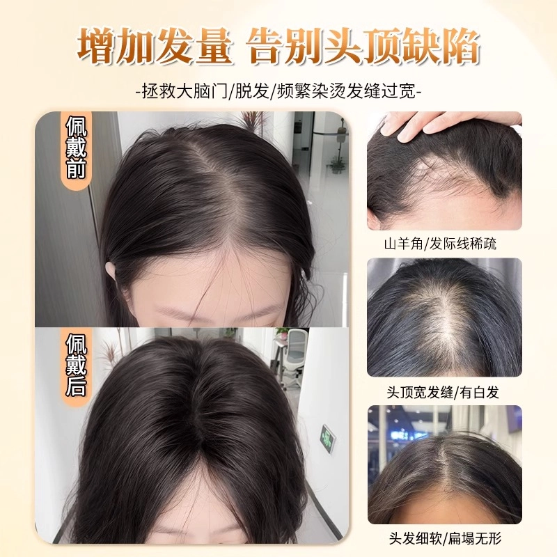 晚晚风 氛围感假发女片 头顶蓬松高颅顶前额自然全真发增发量遮白补发片