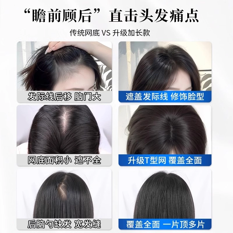 晚晚风 半永久胎毛碎发刘海假发片女 头顶真发高颅顶自然前额遮头顶发际线神器