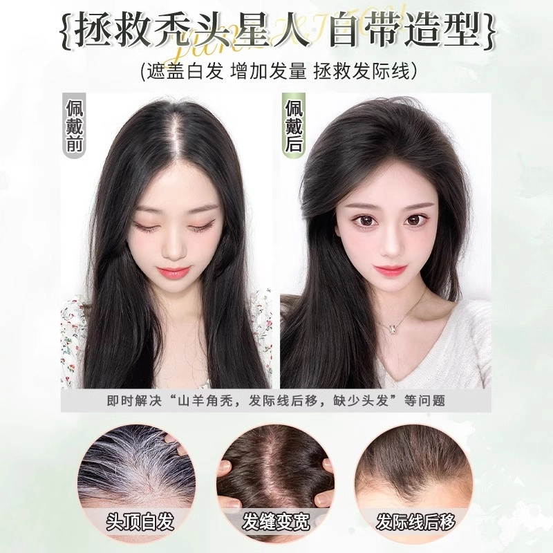 晚晚风 升级蕾丝网假发女片 头顶真发自然前额隐形无痕遮白发增发量蓬松补发片
