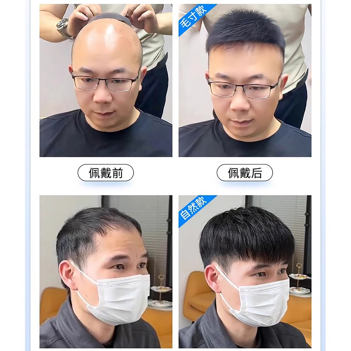 晚晚风 男士秃顶假发片 短发真发帅气隐形头顶补发 自然黑