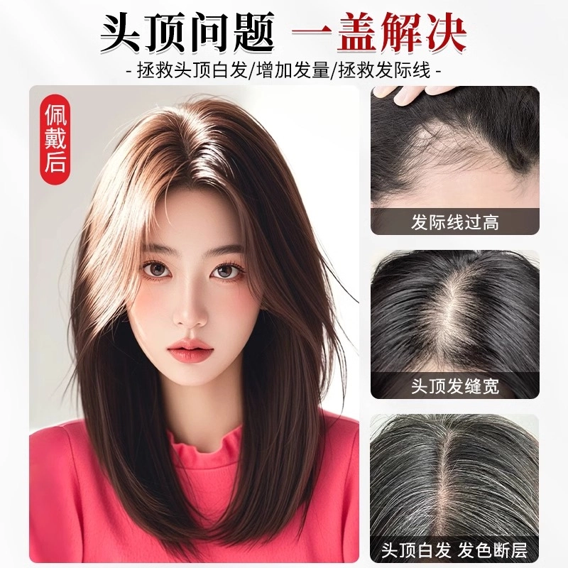 晚晚风 高度逼真递针全真发假发女片 头顶遮白发增发量蓬松高颅顶自然前额补发片