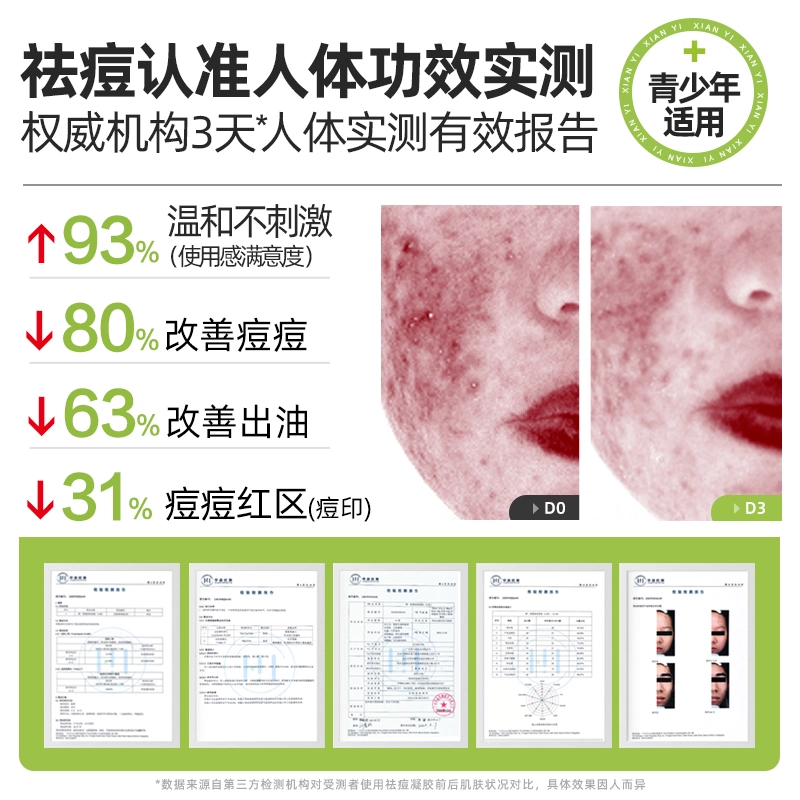 鲜一 清痘护肤套装 祛痘舒缓提亮淡痘印清爽修护补水控油清洁收缩毛孔祛粉刺 五件套