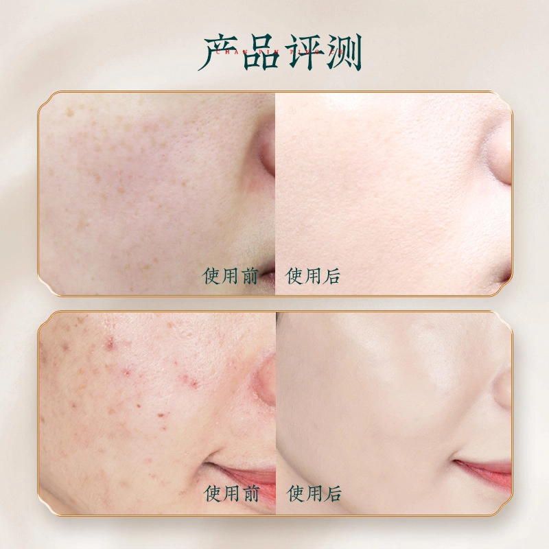 宫佩 花辰玉黛灵芝酵母水乳弹润舒缓肌底护肤套装 淡纹提亮紧致保湿滋润修护补水紧致毛孔淡化细纹