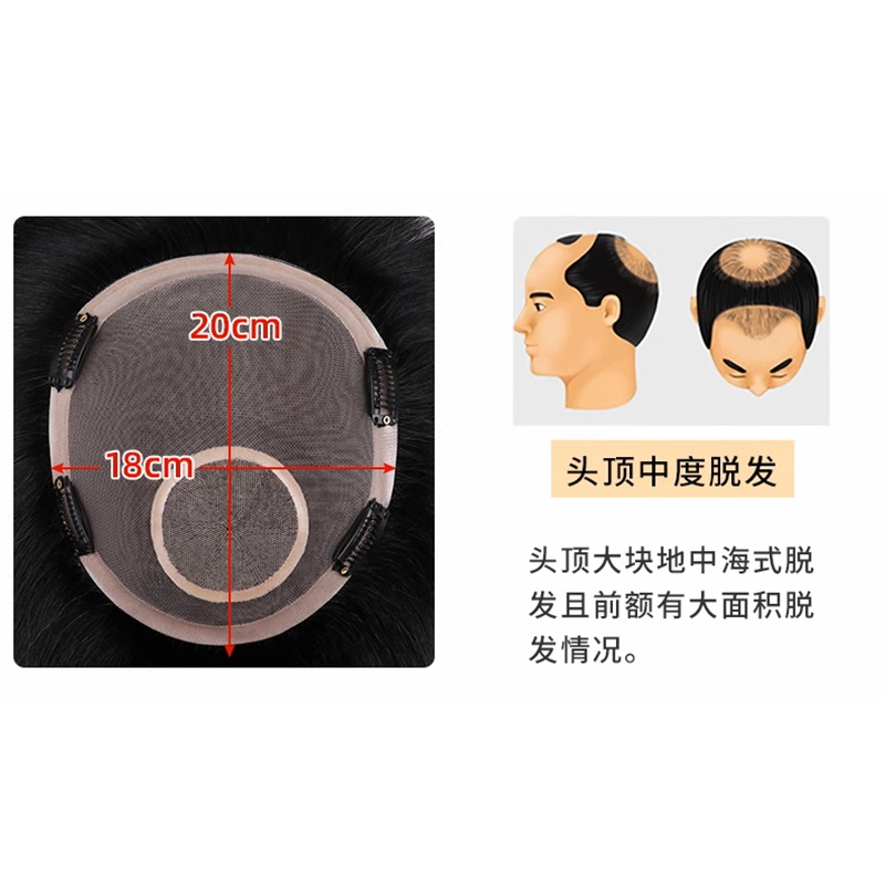 时影 男士头顶补发片 翻盖前额秃顶全手织内网 补发块 男士学生假发