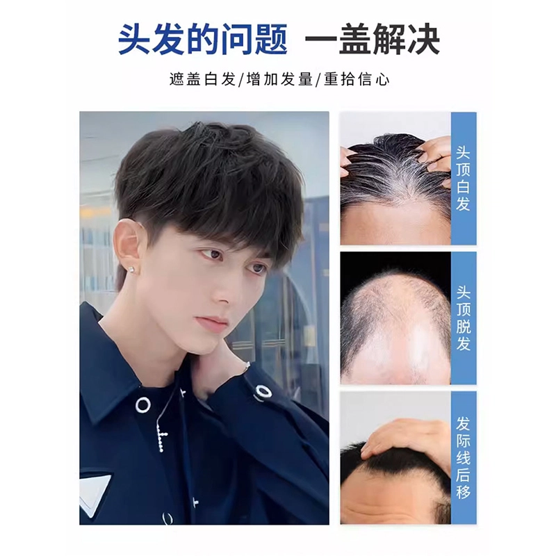 时影 男士头顶补发片 翻盖前额秃顶全手织内网 补发块 男士学生假发