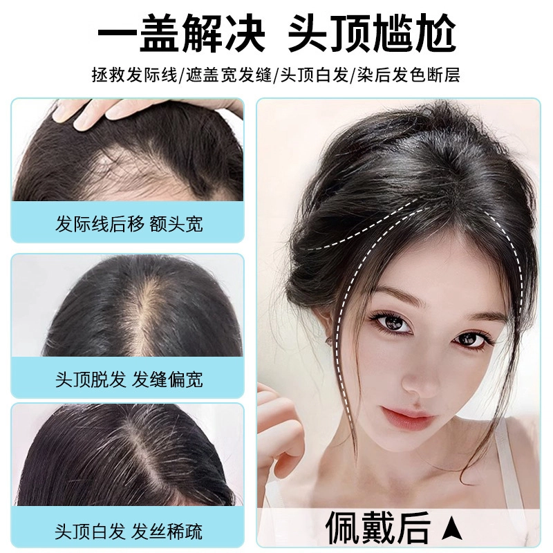 时影 假发片头顶补发 全真发星空网补发片 蓬松高颅顶遮白发 女
