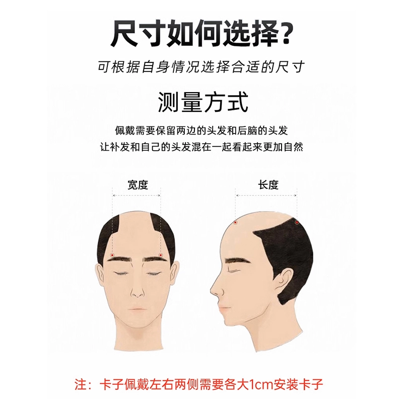 时影 男士头顶补发片 翻盖前额秃顶全手织内网 补发块 男士学生假发