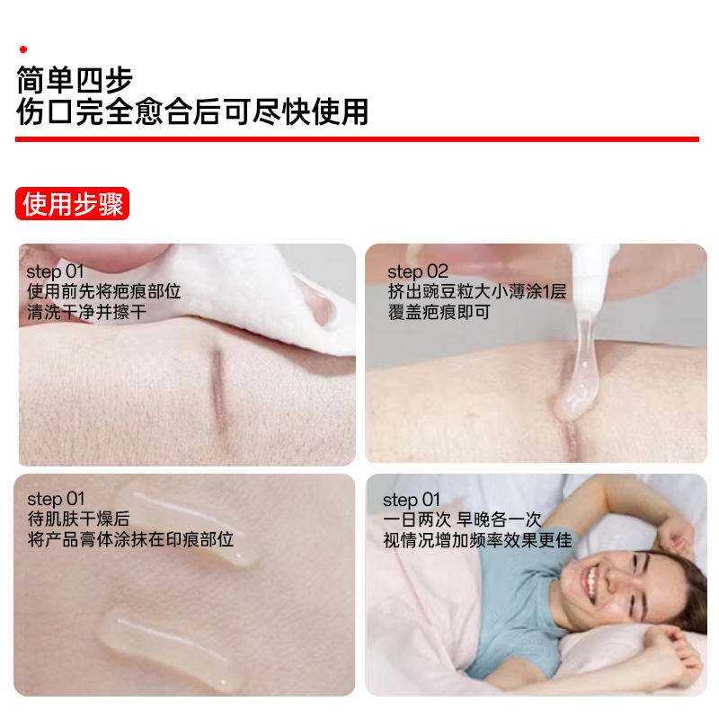界面 医疗疤痕修复膏 剖腹产烫伤疤膏术后医用硅酮凝胶敷料增生凝胶