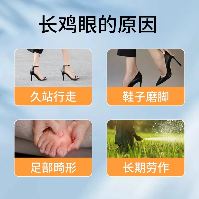 界面 手脚足底瘊子疣跖疣肉刺鸡眼药膏贴去局部降温去除鸡眼贴温和