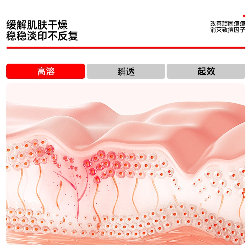 界面 去粉刺黑头壬二酸精华液水杨酸淡化痘印细致毛孔霜改善闭口 护肤 祛痘