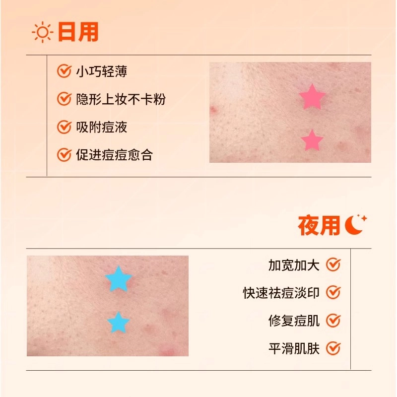 界面 遮瑕贴痘痘贴 医用去痘水胶体敷料修复痘印人工皮净吸脓