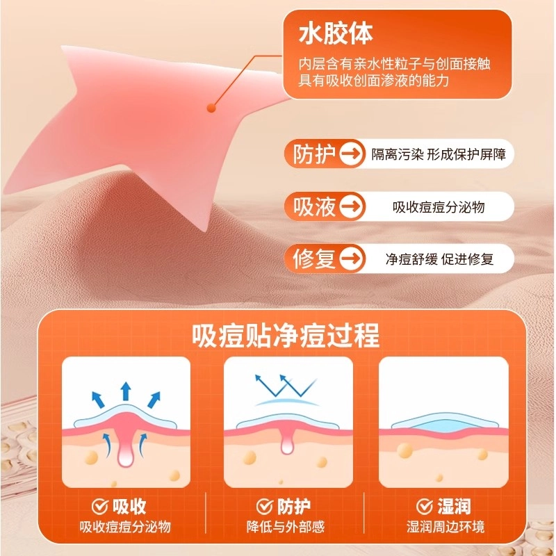 界面 遮瑕贴痘痘贴 医用去痘水胶体敷料修复痘印人工皮净吸脓