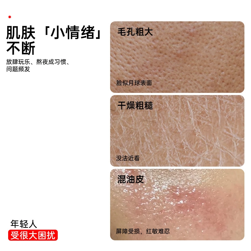 界面 去粉刺黑头壬二酸精华液水杨酸淡化痘印细致毛孔霜改善闭口 护肤 祛痘