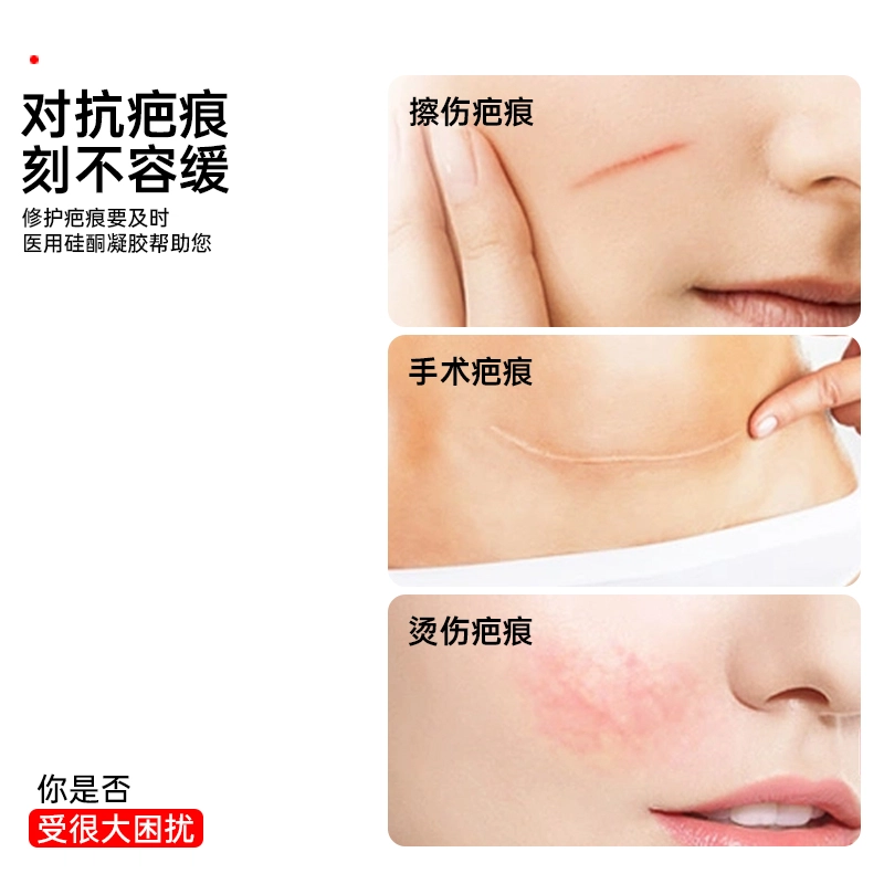 界面 医疗祛疤膏 疤痕修复除疤剖腹产烫伤去疤膏 医用硅酮凝胶