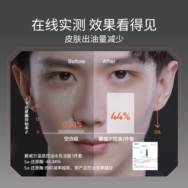爵威尔 男士温泉控油水保湿控油淡痘印清爽滋润舒缓补水  舒缓肌肤持久保湿爽肤水