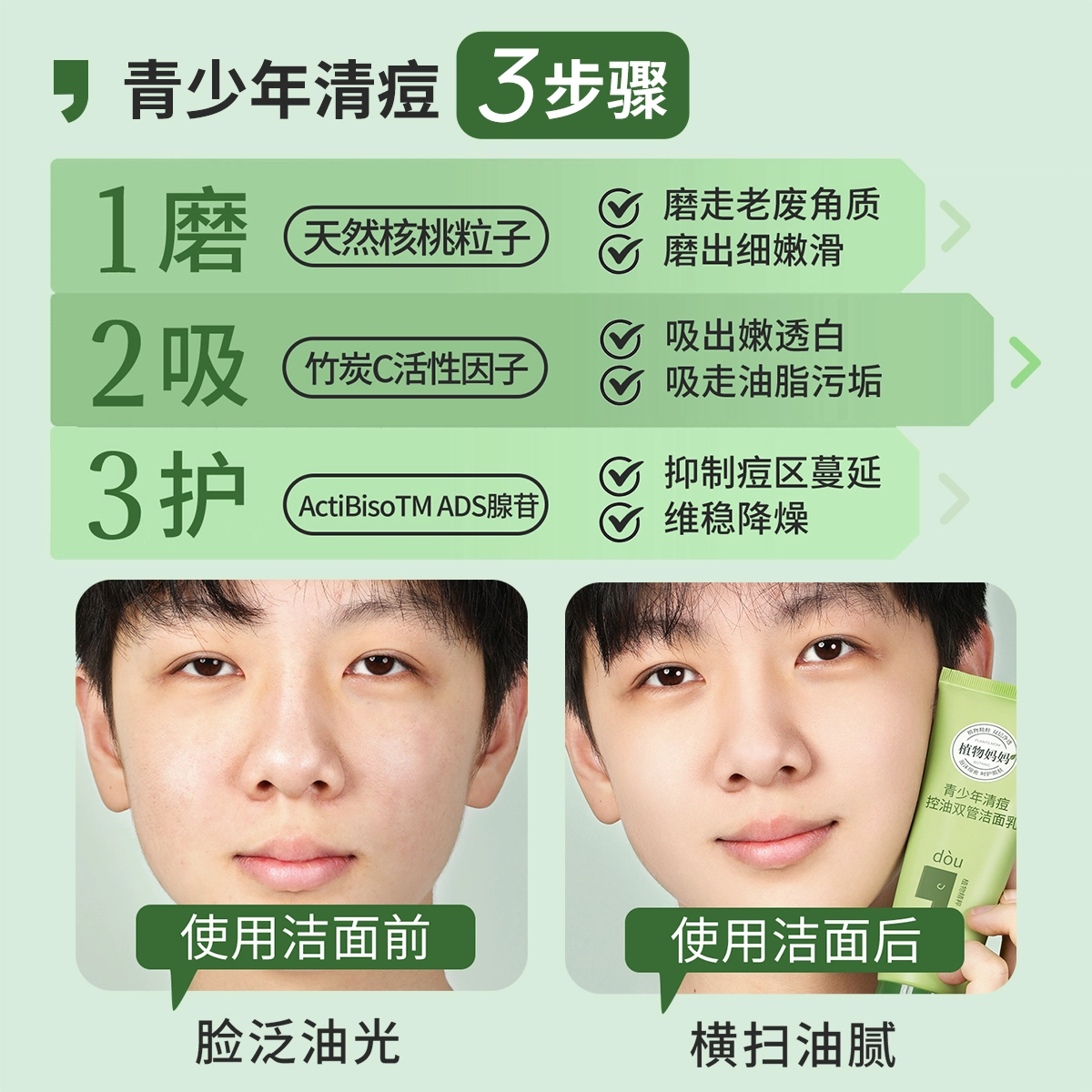植物妈妈 双管洗面奶 祛痘淡痘印去黑头控油