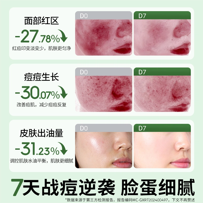 (25ml+2ml)*5
