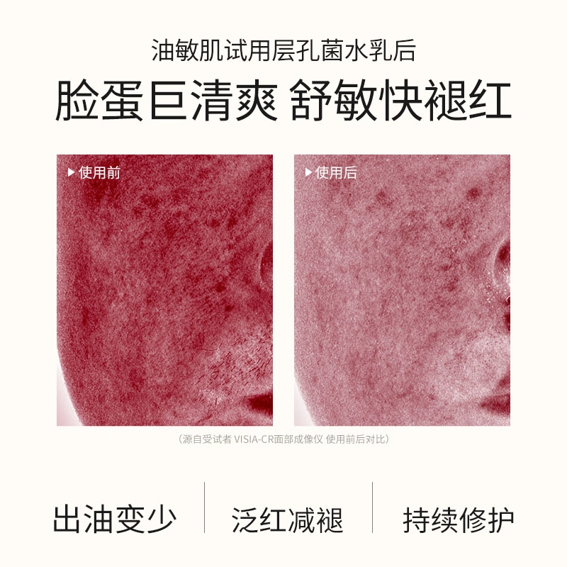 溪木源 层孔菌 水乳洗面奶护肤套装敏感肌混油皮 舒缓修护补水控油清洁