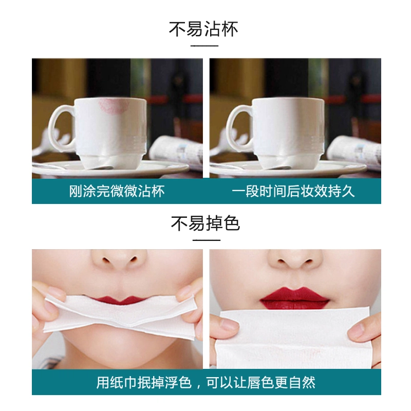 LANYI