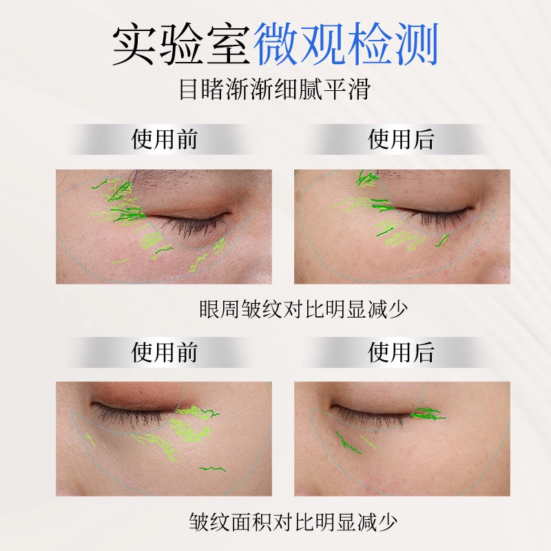 TJE 377+577 12ml24ml48ml