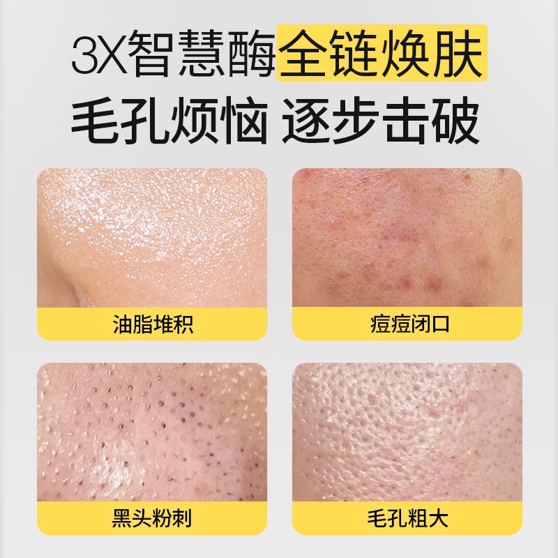 羽素平糙焕肤提亮祛痘祛闭口粉刺修护保湿涂抹式面膜 舒缓去角质控油 混合型肤质油痘肌