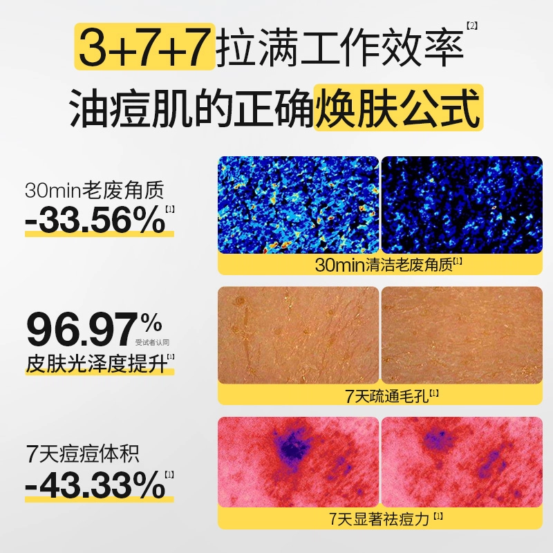 羽素平糙焕肤提亮祛痘祛闭口粉刺修护保湿涂抹式面膜 舒缓去角质控油 混合型肤质油痘肌