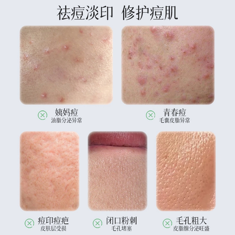 30ml
