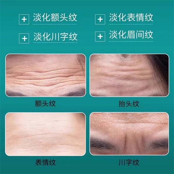 ILSIYA 103050