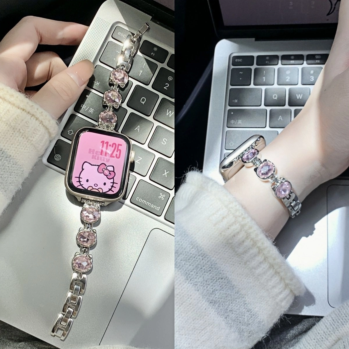 ZS 164mm apple watchS1089se kt